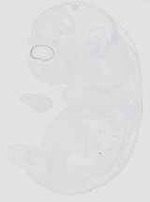 EMAGE:29928