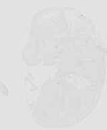 EMAGE:29928
