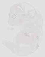 EMAGE:29929