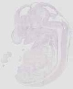 EMAGE:29929
