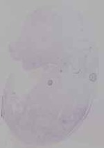 EMAGE:29946
