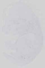 EMAGE:29969