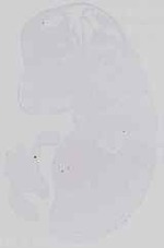 EMAGE:29982