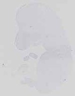 EMAGE:29984