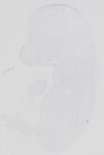 EMAGE:29989