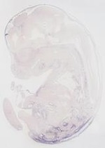 EMAGE:30018