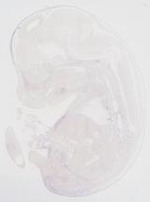 EMAGE:30018