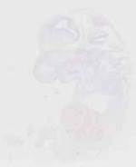 EMAGE:30243