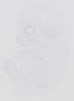 EMAGE:30285