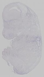 EMAGE:30360