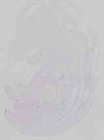 EMAGE:30454