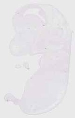 EMAGE:30581