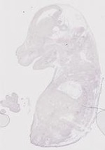 EMAGE:30709