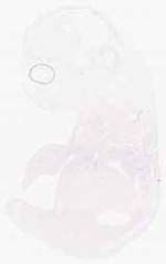 EMAGE:30716