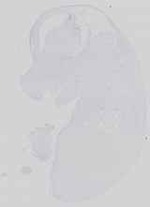 EMAGE:30795