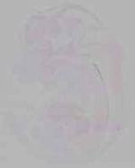 EMAGE:30852