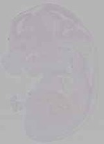 EMAGE:30852
