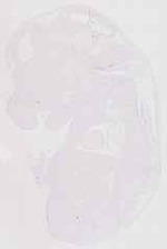 EMAGE:30854
