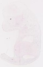 EMAGE:30858