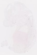 EMAGE:30858