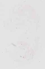 EMAGE:30895