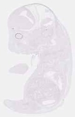 EMAGE:30961