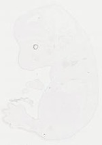 EMAGE:31079