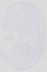 EMAGE:31358