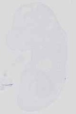 EMAGE:31358