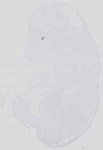 EMAGE:31358