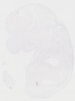 EMAGE:31471
