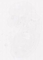 EMAGE:31493
