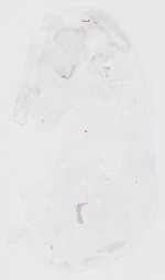 EMAGE:31651