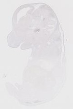 EMAGE:31651