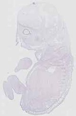 EMAGE:31652