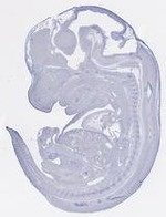 EMAGE:31662