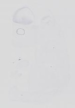 EMAGE:31663
