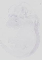 EMAGE:31663
