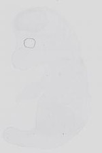 EMAGE:31663