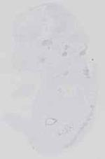 EMAGE:31693
