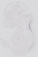 EMAGE:31761