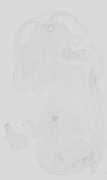 EMAGE:31761