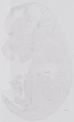 EMAGE:31761
