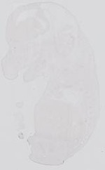 EMAGE:31761