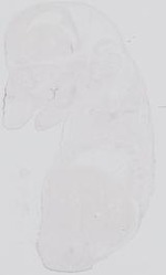 EMAGE:31761