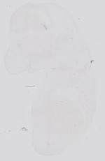 EMAGE:31761
