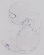 EMAGE:31792
