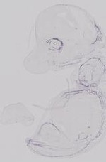 EMAGE:31792