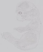 EMAGE:31819