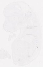 EMAGE:31856